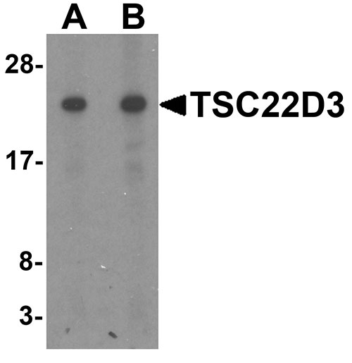 WB - TSC22D3 Antibody ASC11610