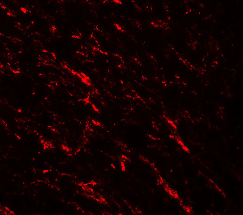 IF - KAT5 Antibody ASC11655