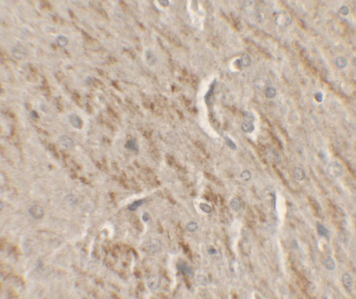 IHC - KAT5 Antibody ASC11655