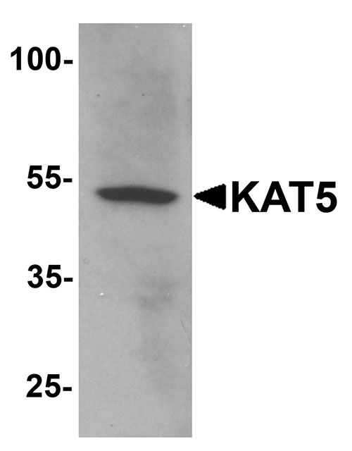 WB - KAT5 Antibody ASC11655