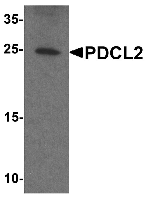 WB - PDCL2 Antibody ASC11820