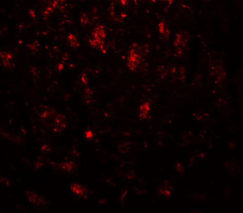 IF - CADM3 Antibody ASC11856