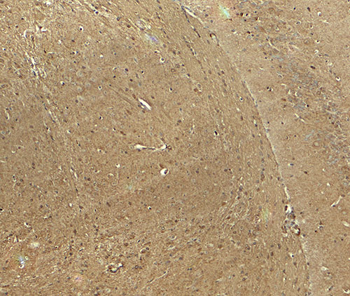 IHC - CADM3 Antibody ASC11856