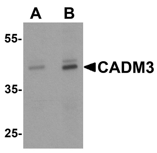 WB - CADM3 Antibody ASC11856