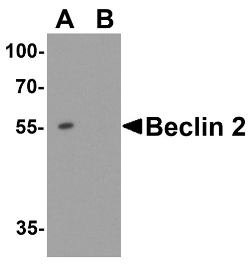 WB - WWC1 Antibody ASC11862