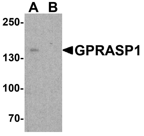 WB - GPRASP1 Antibody ASC11863