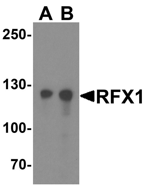 WB - RFX1 Antibody ASC11932