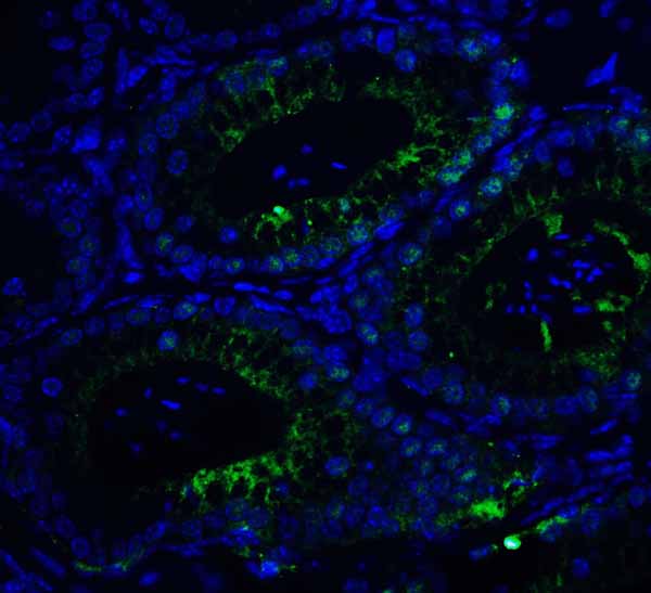 IF - KIR2DS2 Antibody ASC11933