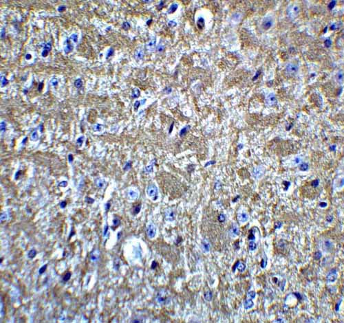 IHC - KIR2DS2 Antibody ASC11933