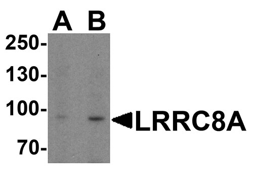 WB - LRRC8A Antibody ASC11942