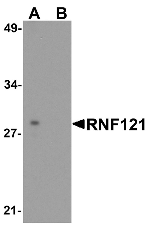 WB - RNF121 Antibody ASC11948