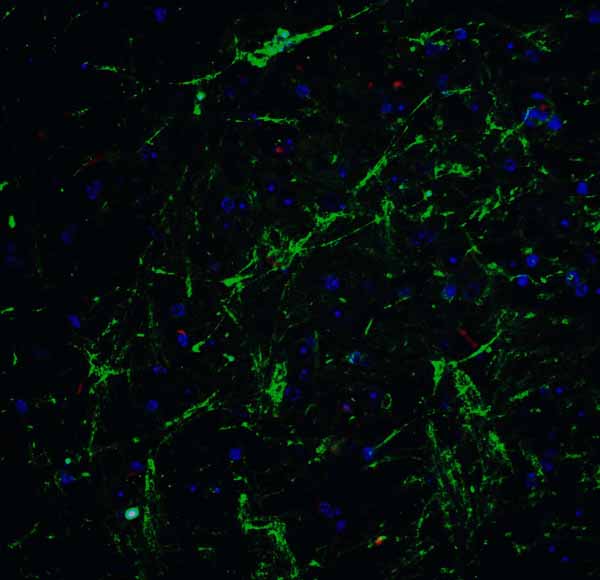 IF - CHADL Antibody ASC11963