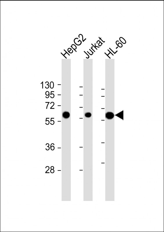 All lanes : Anti-CASP8 Antibody (C-term) at 1:2000 dilutionLane 1: HepG2 whole cell lysateLane 2: Jurkat whole cell lysateLane 3: HL-60 whole cell lysateLysates/proteins at 20 �g per lane. SecondaryGoat Anti-mouse IgG,  (H+L), Peroxidase conjugated at 1/10000 dilution. Predicted band size : 55 kDaBlocking/Dilution buffer: 5% NFDM/TBST.