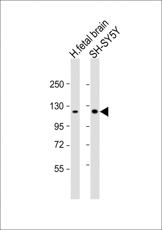 WB - Kif5C-2 Antibody AP12055a
