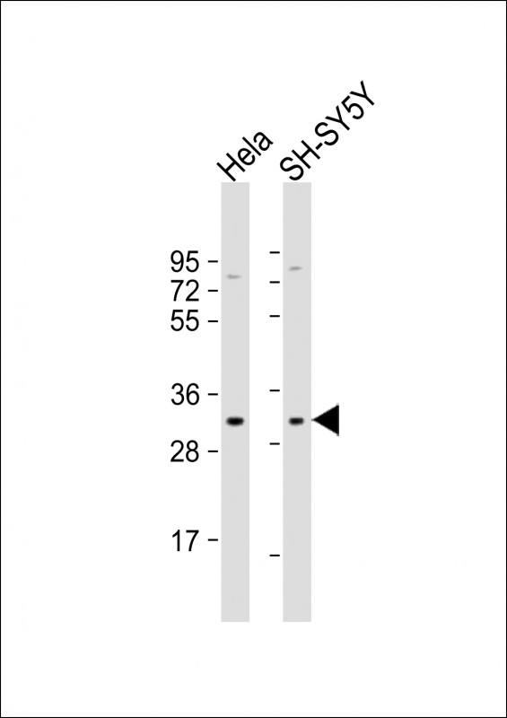 All lanes : Anti-GJB3 Antibody (C211) at 1:1000 dilutionLane 1: Hela whole cell lysateLane 2: SH-SY5Y whole cell lysateLysates/proteins at 20 �g per lane. SecondaryGoat Anti-Rabbit IgG,  (H+L), Peroxidase conjugated at 1/10000 dilution. Predicted band size : 31 kDaBlocking/Dilution buffer: 5% NFDM/TBST.