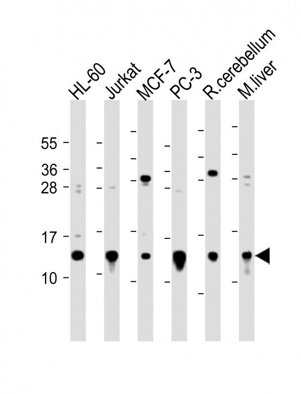 All lanes : Anti-FUBI Antibody (C-term) at 1:2000 dilutionLane 1: HL-60 whole cell lysateLane 2: Jurkat whole cell lysateLane 3: MCF-7 whole cell lysateLane 4: PC-3 whole cell lysateLane 5: rat cerebellum lysateLane 6: mouse liver lysateLysates/proteins at 20 �g per lane. SecondaryGoat Anti-Rabbit IgG,  (H+L), Peroxidase conjugated at 1/10000 dilution. Predicted band size : 7 kDaBlocking/Dilution buffer: 5% NFDM/TBST.