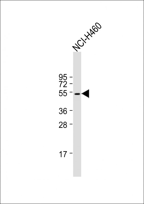 WB - KRT36 Antibody (N-term) AP17586a