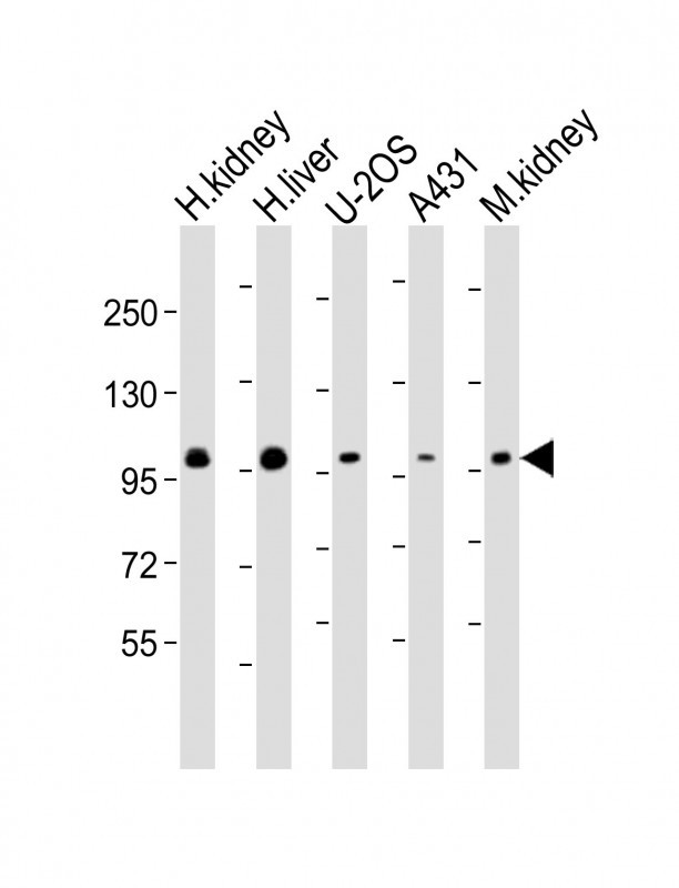 All lanes : Anti-ACO1 Antibody (Center) at 1:2000 dilutionLane 1: human kidney lysateLane 2: human liver lysateLane 3: U-2OS whole cell lysateLane 4: A431 whole cell lysateLane 5: mouse kidney lysateLysates/proteins at 20 �g per lane. SecondaryGoat Anti-Rabbit IgG,  (H+L), Peroxidase conjugated at 1/10000 dilution. Predicted band size : 98 kDaBlocking/Dilution buffer: 5% NFDM/TBST.