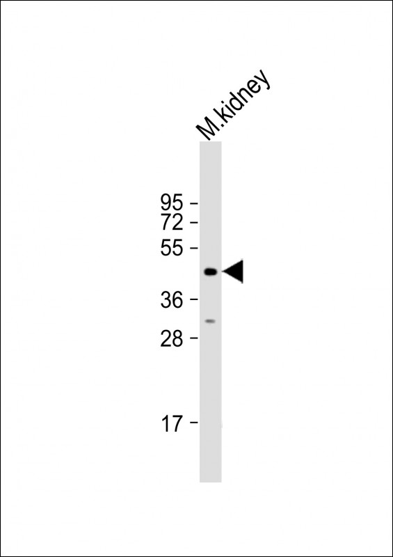 Anti-ACP6 Antibody (N-Term) at 1:2000 dilution + mouse kidney lysateLysates/proteins at 20 �g per lane. SecondaryGoat Anti-Rabbit IgG,  (H+L), Peroxidase conjugated at 1/10000 dilution. Predicted band size : 49 kDaBlocking/Dilution buffer: 5% NFDM/TBST.