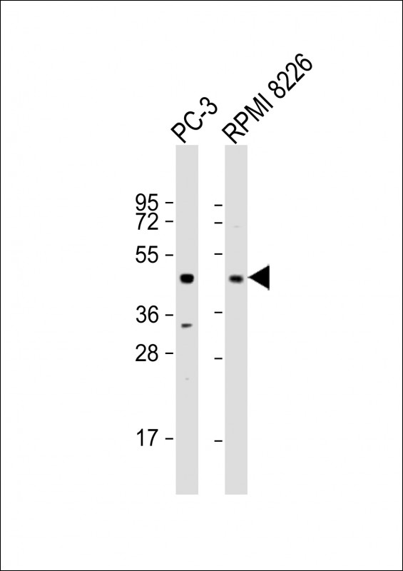 All lanes : Anti-ACP6 Antibody (Center) at 1:2000 dilutionLane 1: PC-3 whole cell lysateLane 2: RPMI 8226 whole cell lysateLysates/proteins at 20 �g per lane. SecondaryGoat Anti-Rabbit IgG,  (H+L), Peroxidase conjugated at 1/10000 dilution. Predicted band size : 49 kDaBlocking/Dilution buffer: 5% NFDM/TBST.