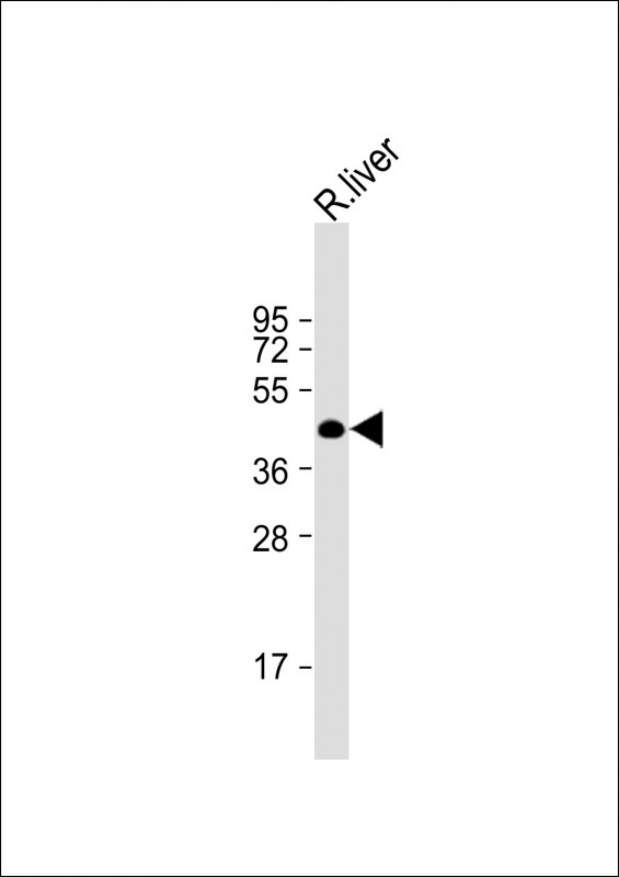 Anti-BAAT Antibody (N-Term) at 1:2000 dilution + rat liver lysateLysates/proteins at 20 �g per lane. SecondaryGoat Anti-Rabbit IgG,  (H+L), Peroxidase conjugated at 1/10000 dilution. Predicted band size : 46 kDaBlocking/Dilution buffer: 5% NFDM/TBST.