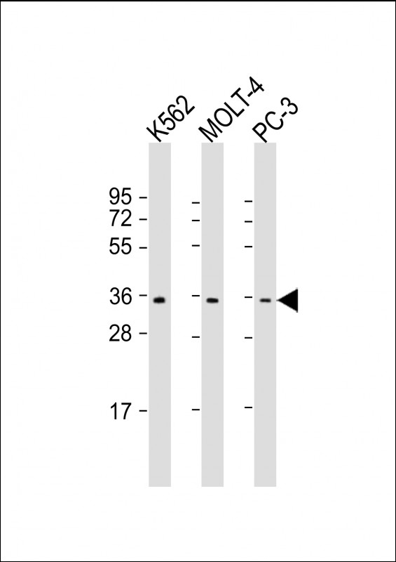All lanes : Anti-PIGC Antibody (C-Term) at 1:1000 dilutionLane 1: K562 whole cell lysateLane 2: MOLT-4 whole cell lysateLane 3: PC-3 whole cell lysateLysates/proteins at 20 �g per lane. SecondaryGoat Anti-Rabbit IgG,  (H+L), Peroxidase conjugated at 1/10000 dilution. Predicted band size : 34 kDaBlocking/Dilution buffer: 5% NFDM/TBST.