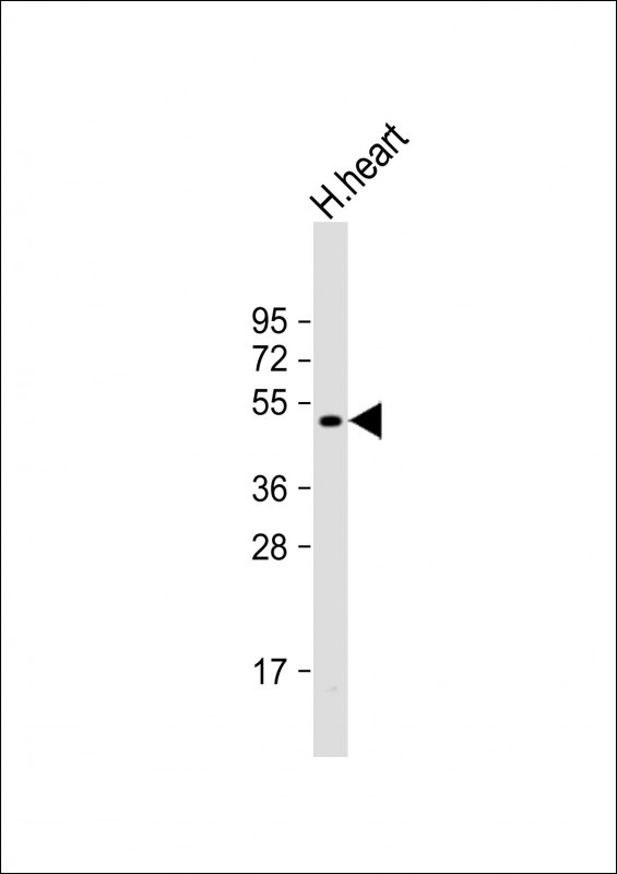 WB - PDK4 Antibody (C-term) AP7041B