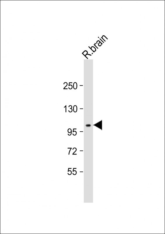 Anti-DDR1 Antibody (N-term) at 1:2000 dilution + rat brain lysateLysates/proteins at 20 �g per lane. SecondaryGoat Anti-Rabbit IgG,  (H+L), Peroxidase conjugated at 1/10000 dilution. Predicted band size : 101 kDaBlocking/Dilution buffer: 5% NFDM/TBST.