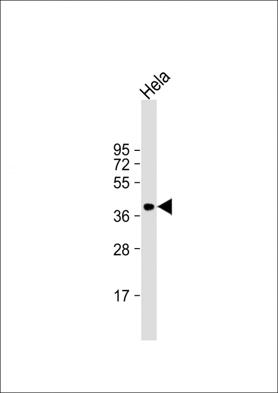 Anti-ARPC1B Antibody (Center) at 1:1000 dilution + Hela whole cell lysateLysates/proteins at 20 �g per lane. SecondaryGoat Anti-Rabbit IgG,  (H+L), Peroxidase conjugated at 1/10000 dilution. Predicted band size : 41 kDaBlocking/Dilution buffer: 5% NFDM/TBST.
