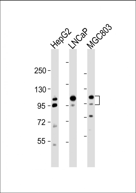 All lanes : Anti-ANO7 Antibody (N-term) at 1:2000 dilutionLane 1: HepG2 whole cell lysateLane 2: LNCaP whole cell lysateLane 3: MGC803 whole cell lysateLysates/proteins at 20 �g per lane. SecondaryGoat Anti-Rabbit IgG,  (H+L), Peroxidase conjugated at 1/10000 dilution. Predicted band size : 106 kDaBlocking/Dilution buffer: 5% NFDM/TBST.