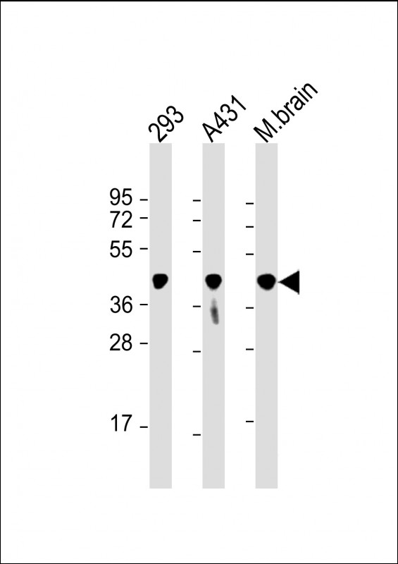 All lanes : Anti-PGK1 Antibody at 1:8000 dilutionLane 1: 293 whole cell lysateLane 2: A431 whole cell lysateLane 3: mouse brain lysateLysates/proteins at 20 �g per lane. SecondaryGoat Anti-mouse IgG,  (H+L), Peroxidase conjugated at 1/10000 dilution. Predicted band size : 45 kDaBlocking/Dilution buffer: 5% NFDM/TBST.