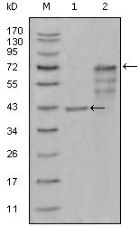 WB - CHIT1 Antibody AO1251a