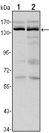 WB - KDM3A Antibody AO1486a