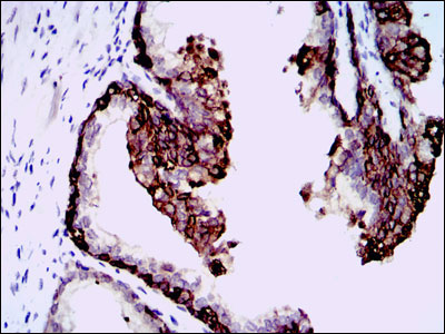 IHC - HAS3 Antibody AO1707a