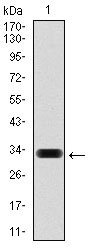 WB - HAS3 Antibody AO1707a