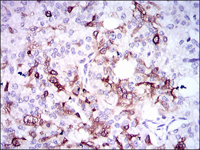 IHC - SPP1 Antibody AO1790a