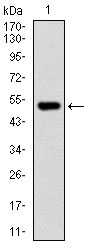 WB - PHC1 Antibody AO1803a