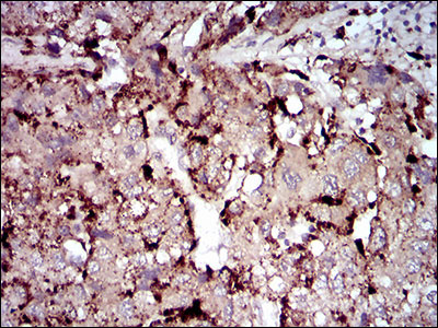 IHC - PLA2G12A Antibody AO1930a