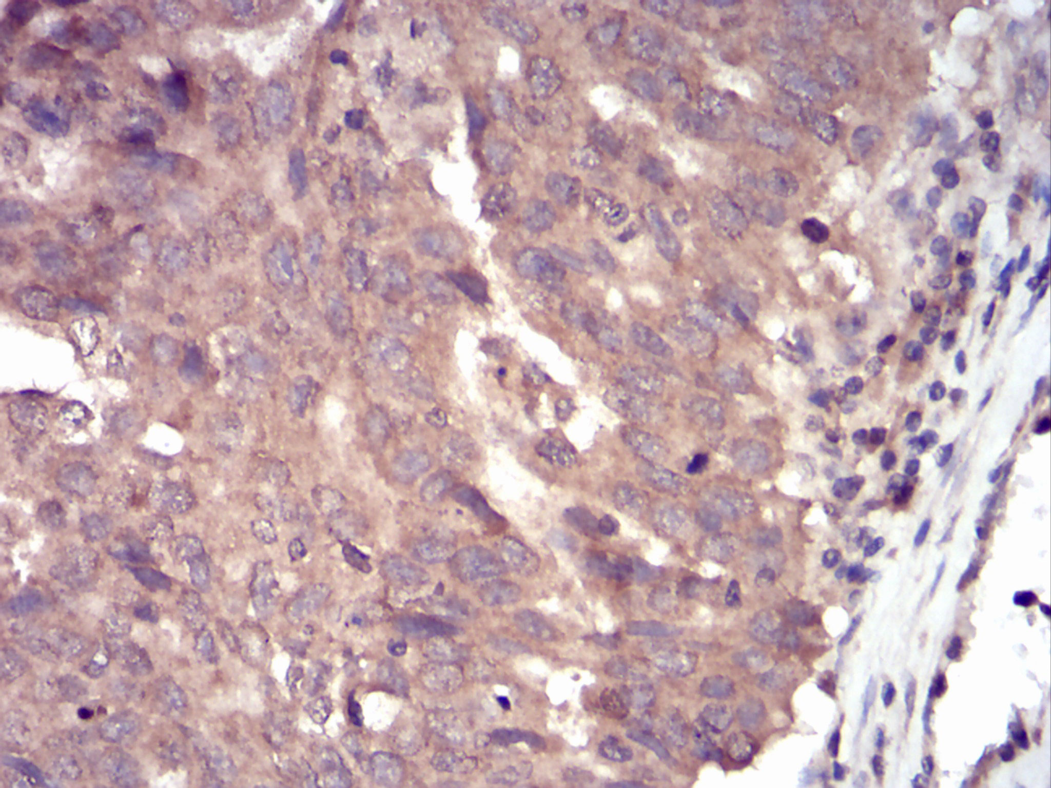 IHC - SLINGSHOT-1L Antibody AO2008a