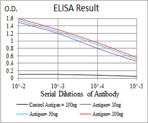 E - TIP60 Antibody AO2029a