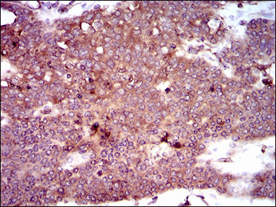 IHC - DCTN4 Antibody AO2291a