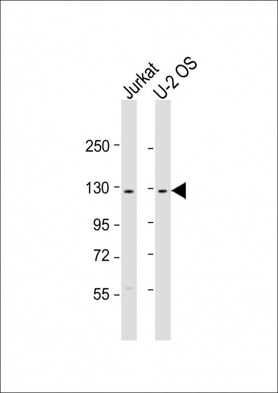 All lanes : Anti-CENTG1 Antibody (C-term) at 1:2000 dilutionLane 1: Jurkat whole cell lysateLane 2: U-2 OS whole cell lysateLysates/proteins at 20 �g per lane. SecondaryGoat Anti-Rabbit IgG,  (H+L), Peroxidase conjugated at 1/10000 dilution. Predicted band size : 125 kDaBlocking/Dilution buffer: 5% NFDM/TBST.