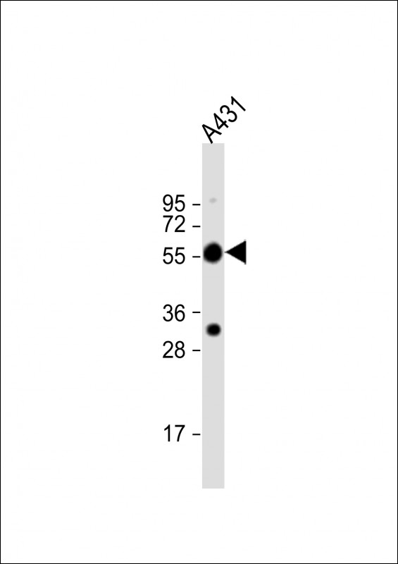 WB - TUBA1C Antibody (C-term) AP12043b
