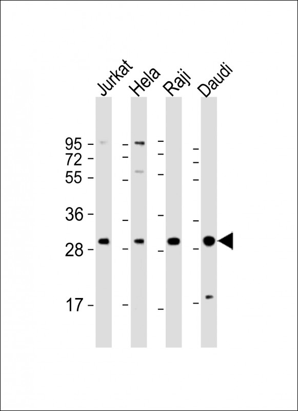 All lanes : Anti-ANP32A Antibody (Center) at 1:2000 dilutionLane 1: Jurkat whole cell lysateLane 2: Hela whole cell lysateLane 3: Raji whole cell lysateLane 4: Daudi whole cell lysateLysates/proteins at 20 �g per lane. SecondaryGoat Anti-Rabbit IgG,  (H+L), Peroxidase conjugated at 1/10000 dilution. Predicted band size : 29 kDaBlocking/Dilution buffer: 5% NFDM/TBST.