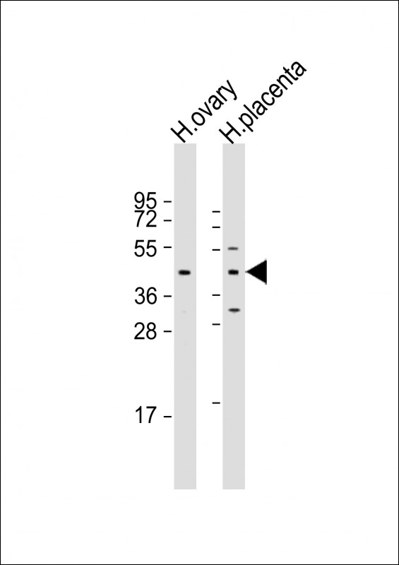 All lanes : Anti-ESX1 Antibody (N-term) at 1:1000-1:2000 dilutionLane 1: human ovary lysateLane 2: human placenta lysateLysates/proteins at 20 �g per lane. SecondaryGoat Anti-Rabbit IgG,  (H+L), Peroxidase conjugated at 1/10000 dilution. Predicted band size : 44 kDaBlocking/Dilution buffer: 5% NFDM/TBST.