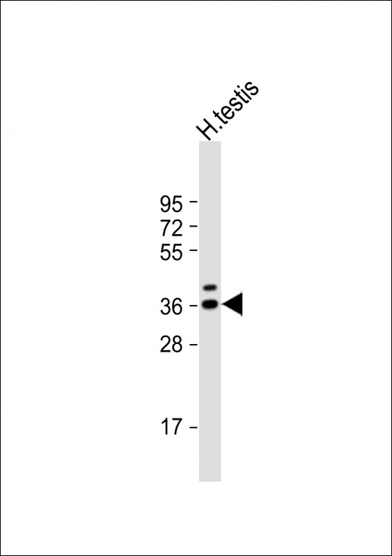 WB - TSPY3 Antibody (C-term) AP17280b