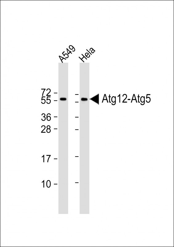 WB - ATG12 Antibody (N-term) AP1816a
