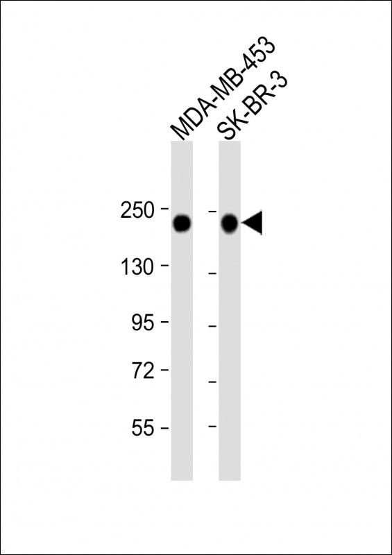 All lanes : Anti-ERBB2 Antibody (C-term Y1139) at 1:2000 dilutionLane 1: MDA-MB-453 whole cell lysateLane 2: SK-BR-3 whole cell lysateLysates/proteins at 20 �g per lane.  SecondaryGoat Anti-Rabbit IgG,   (H+L),  Peroxidase conjugated at 1/10000 dilution.  Predicted band size : 138 kDaBlocking/Dilution buffer: 5% NFDM/TBST.