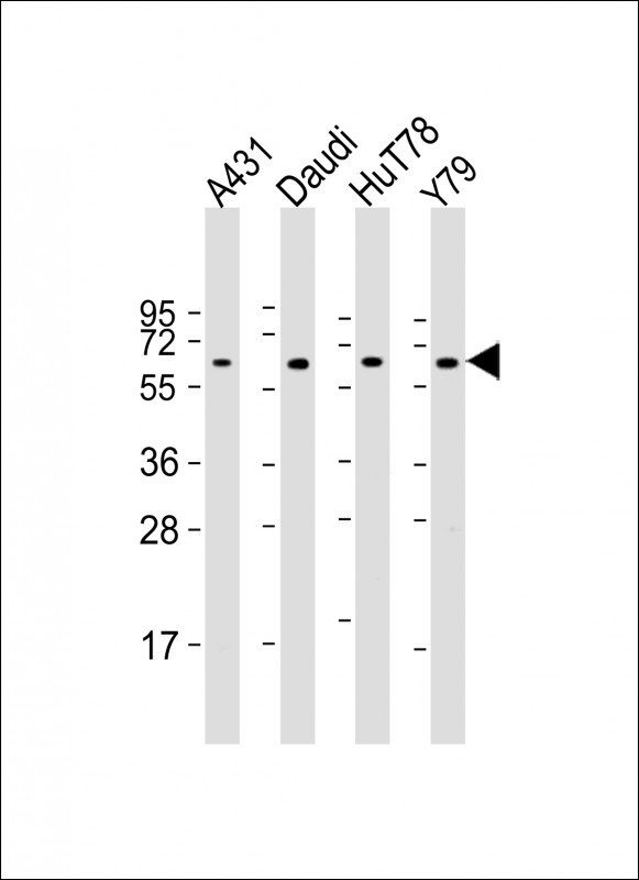 WB - YY1 Antibody (Center) AP19325c