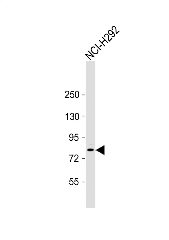 Anti-ZNF12 Antibody (N-term) at 1:1000 dilution + NCI-H292 whole cell lysateLysates/proteins at 20 �g per lane. SecondaryGoat Anti-Rabbit IgG,  (H+L), Peroxidase conjugated at 1/10000 dilution. Predicted band size : 81 kDaBlocking/Dilution buffer: 5% NFDM/TBST.